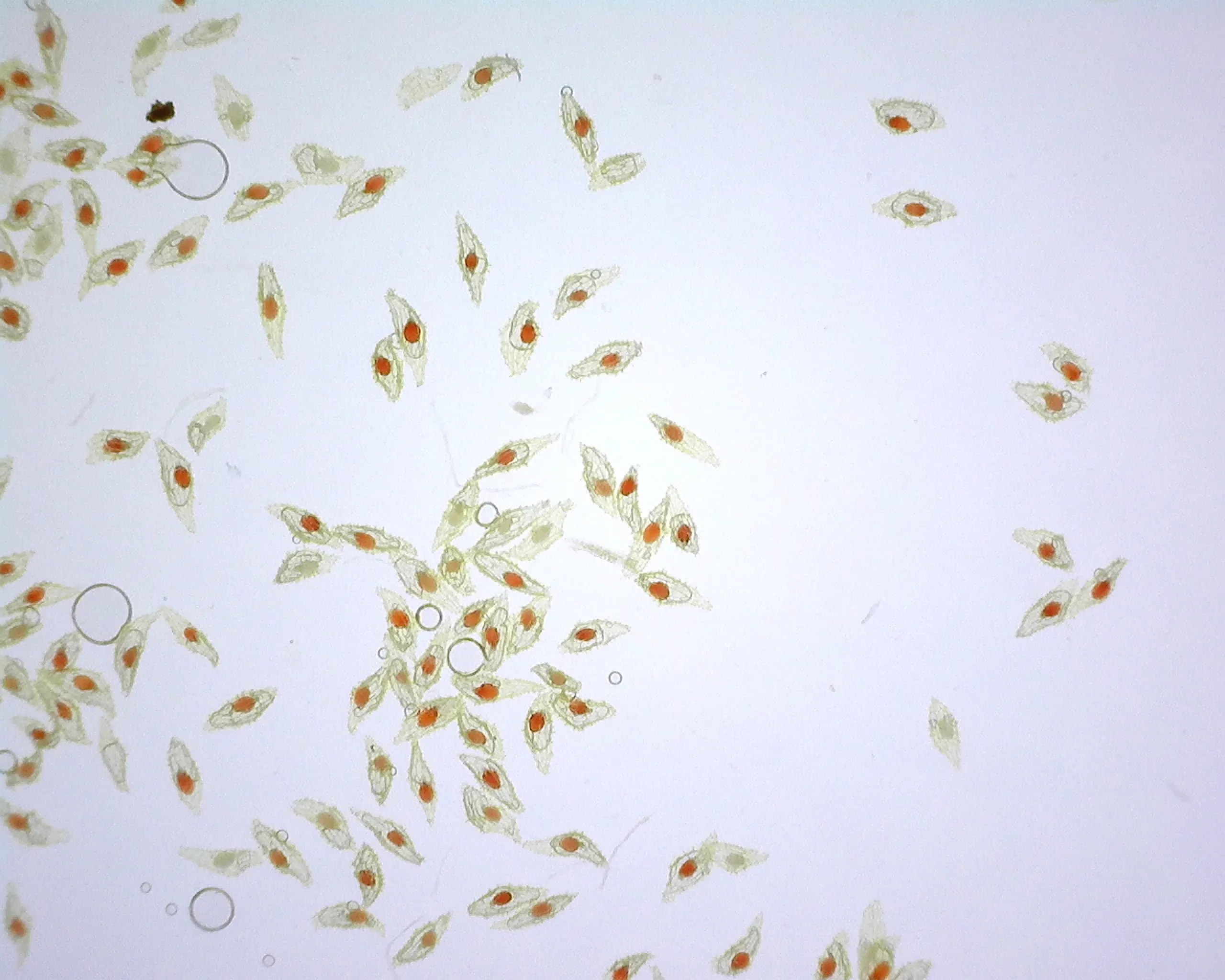 Orchid seeds imaged through a microscopic USB camera; the viable seeds are stained red by Tetrazolium Chloride - Abigail Tucker © RBG Kew Approximately 100 orchid seeds, most of their embryos stained red by Tetrazolium Chloride. Some embryos are left transparent or grey in colour.